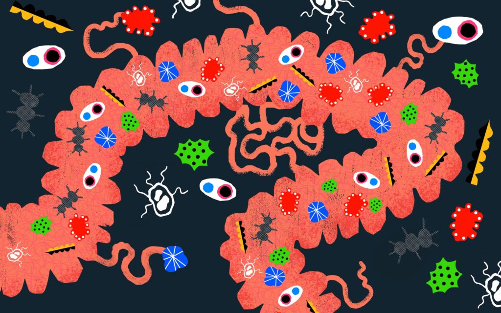 Irritable Bowel Syndrome (IBS)​