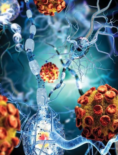 Colonics for Autoimmune Disease ​